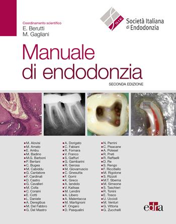 Manuale di endodonzia  - Libro Edra 2020 | Libraccio.it