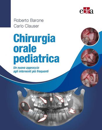 Chirurgia orale pediatrica. Un nuovo approccio agli interventi più frequenti - Roberto Barone, Carlo Clauser - Libro Edra 2022 | Libraccio.it
