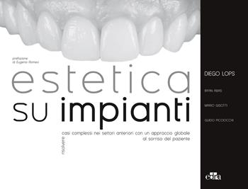 Estetica su impianti. Risolvere casi complessi nei settori anteriori con un approccio globale al sorriso del paziente - Diego Lops, Mario Gisotti, Guido Picciocchi - Libro Edra 2020 | Libraccio.it