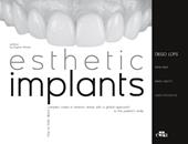 Esthetic implants. How to think about complex cases in anterior areas with a global approach to the patient' s smile