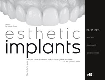Esthetic implants. How to think about complex cases in anterior areas with a global approach to the patient' s smile - Diego Lops, Mario Gisotti, Guido Picciocchi - Libro Edra 2020 | Libraccio.it