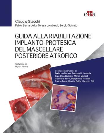 Guida alla riabilitazione implantoprotesica del mascellare posteriore atrofico - Claudio Stacchi, Fabio Bernardello, Teresa Lombardi - Libro Edra 2021 | Libraccio.it