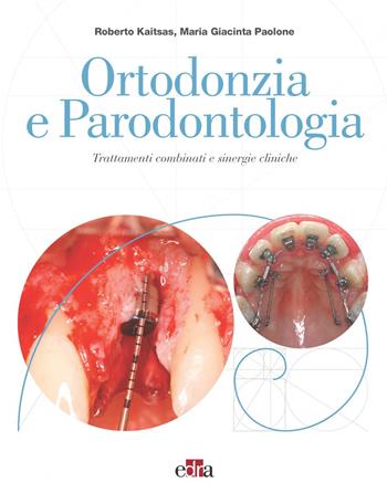 Ortodonzia e parodontologia. Trattamenti combinati e sinergie cliniche - Roberto Kaitsas, Maria Giacinta Paolone - Libro Edra 2021 | Libraccio.it