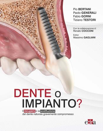 Dente o impianto? Il recupero o la sostituzione del dente naturale gravemente compromesso - Pio Bertani, Paolo Generali, Fabio Gorni - Libro Edra 2023 | Libraccio.it