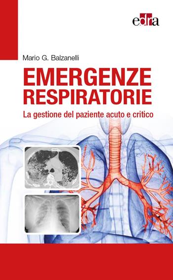 Emergenze respiratorie. La gestione del paziente acuto e critico - Mario Giosuè Balzanelli - Libro Edra 2022 | Libraccio.it