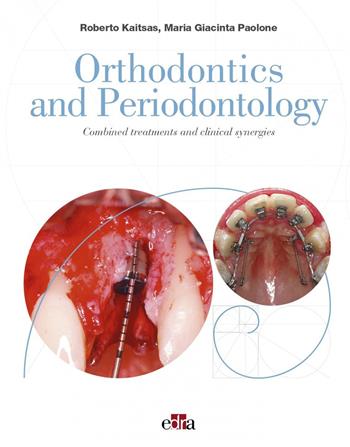 Orthodontics and Periodontology. Combined treatments and clinical synergies - Roberto Kaitsas, Maria Giacinta Paolone - Libro Edra 2021 | Libraccio.it