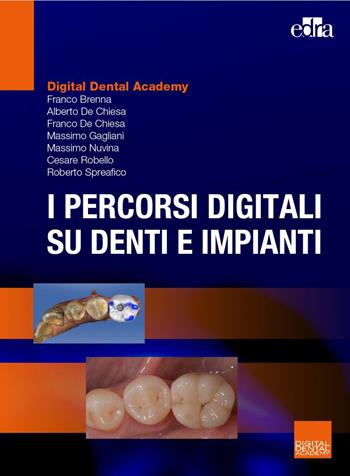 I percorsi digitali su denti e impianti - Franco Brenna, Franco De Chiesa, Alberto De Chiesa - Libro Edra 2022 | Libraccio.it