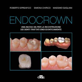 Endocrown. Una nuova via per la ricostruzione dei denti trattati endodonticamente - Roberto Spreafico, Simona Chirico, Massimo Gagliani - Libro Edra 2024 | Libraccio.it