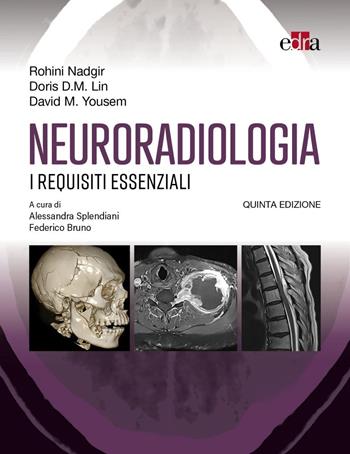 Neuroradiologia. I requisiti essenziali - Rohini Nadgir, Doris D. M. Lin, David M. Yousem - Libro Edra 2025 | Libraccio.it
