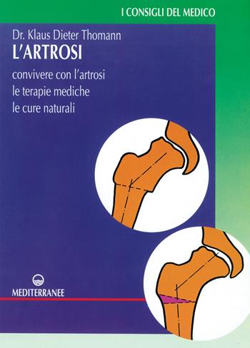 L' artrosi. Come convivere con l'artrosi. Le terapie mediche, le cure individuali - Klaus-Dieter Thomann - Libro Edizioni Mediterranee 1996, Medicina sportiva | Libraccio.it