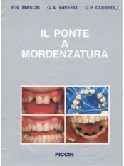 Il ponte a mordenzatura - P. Nicola Mason, G. Antonio Favero, G. P. Cordioli - Libro Piccin-Nuova Libraria 1992 | Libraccio.it