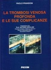 La trombosi venosa profonda e le sue complicanze