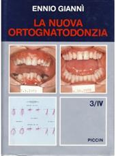 La nuova ortognatodonzia (3/4)