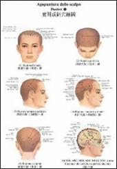 Tavole di agopuntura della scalpo