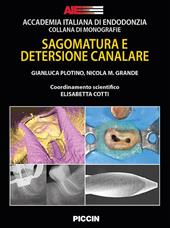 Sagomatura e detersione canalare