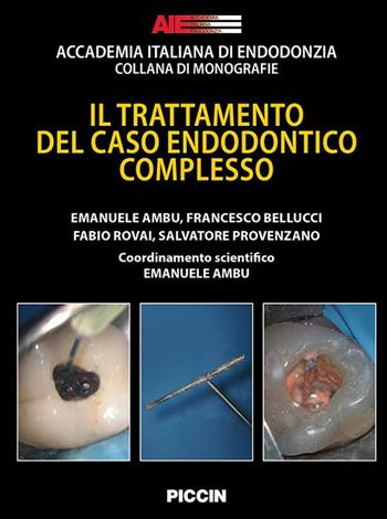 Il trattamento del caso endodontico complesso - Emanuele Ambu, Francesco Bellucci, Fabio Rovai - Libro Piccin-Nuova Libraria 2024 | Libraccio.it