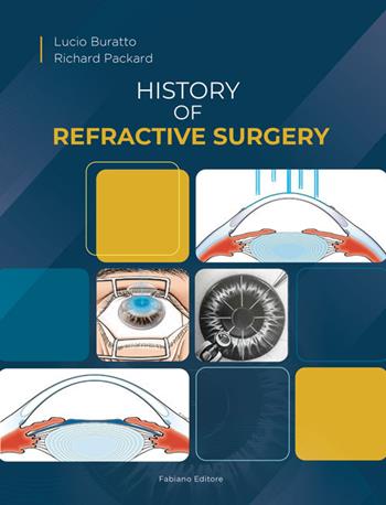 History of refractive surgery - Lucio Buratto, Richard Packard - Libro Fabiano 2020 | Libraccio.it