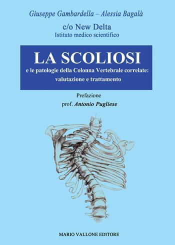 La scoliosi e le patologie della colonna vertebrale correlate: valutazione e trattamento - Giuseppe Gambardella, Alessia Bagalà - Libro Mario Vallone 2020 | Libraccio.it