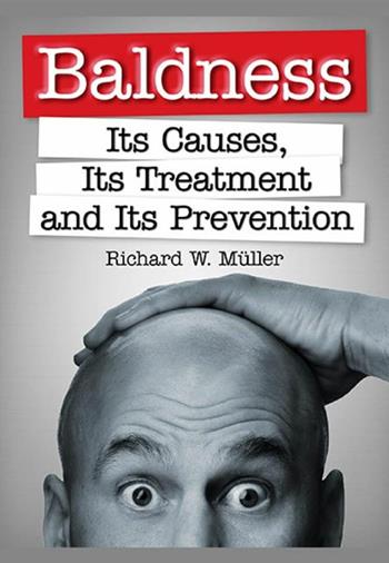 Baldness. Its causes, its treatment and its prevention - Richard W. Müller - Libro StreetLib 2019 | Libraccio.it