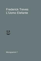 L' uomo elefante