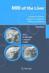 Mri of the liver. Imaging techniques, contrast enhancement, differential diagnosis - Guenther Schneider, Luigi Grazioli, Sanjay Saini - Libro Springer Verlag 2006 | Libraccio.it