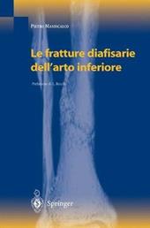 Le fratture diafisarie dell'arto inferiore