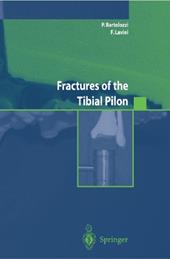 Fractures of the tibial pilon. Ediz. inglese