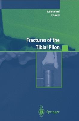 Fractures of the tibial pilon. Ediz. inglese  - Libro Springer Verlag 2004, Ortopedia e chirurgia mininvasiva | Libraccio.it