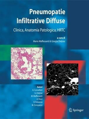 Pneumopatie infiltrative diffuse. Clinica, anatomia patologica, HRTC  - Libro Springer Verlag 2004 | Libraccio.it