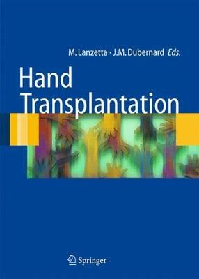 Hand transplantation. Con CD-ROM  - Libro Springer Verlag 2007, Ortopedia e chirurgia mininvasiva | Libraccio.it