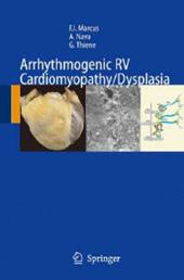 Arrhythmogenic RV cardiomyopathy/dysplasia recent advances