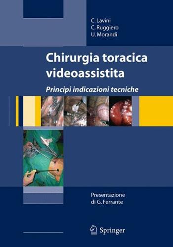 Chirurgia toracica videoassistita - Corrado Lavini, Ciro Ruggiero, Uliano Morandi - Libro Springer Verlag 2007 | Libraccio.it