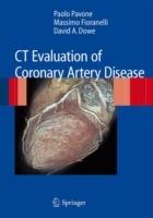 CT evaluation of coronary artery disease