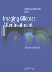 Imaging gliomas after treatment
