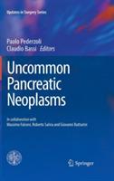 Uncommon pancreatic neoplasms  - Libro Springer Verlag 2012 | Libraccio.it