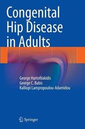 Congenital hip disease in adults
