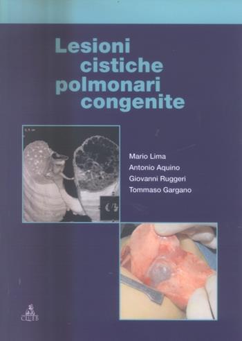 Lesioni cistiche polmonari congenite - Mario Lima, Antonio Aquino, Giovanni Ruggeri - Libro CLUEB 2005 | Libraccio.it