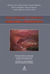 Ernia inguinale congenita. Correzione laparoscopica