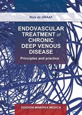 Endovascular treatment of chronic deep venous disease. Principles and practice