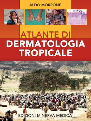 Atlante di dermatologia tropicale - Aldo Morrone - Libro Minerva Medica 2022 | Libraccio.it
