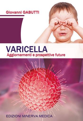 Varicella. Aggiornamenti e prospettive future - Giovanni Gabutti - Libro Minerva Medica 2023 | Libraccio.it