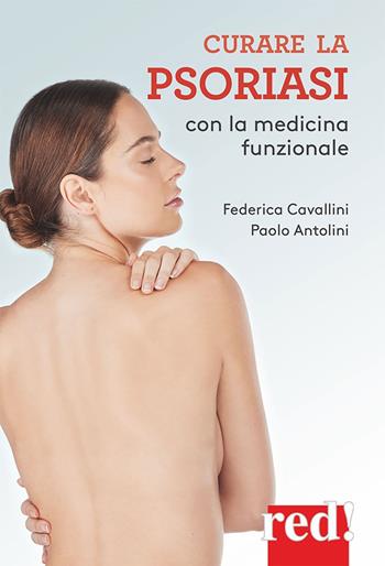 Curare la psoriasi con la medicina funzionale - Federica Cavallini, Paolo Antolini - Libro Red Edizioni 2023, Economici di qualità | Libraccio.it