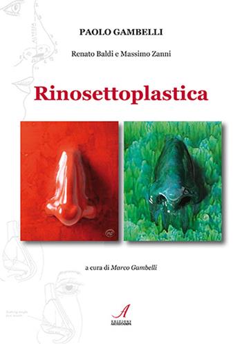 Rinosettoplastica - Paolo Gambelli, Renato Baldi, Massimo Zanni - Libro Edizioni Artestampa 2022 | Libraccio.it
