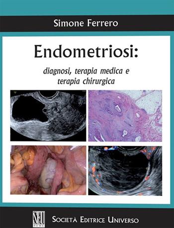 Endometriosi: diagnosi, terapia medica e terapia chirurgica - Simone Ferrero - Libro SEU 2021 | Libraccio.it