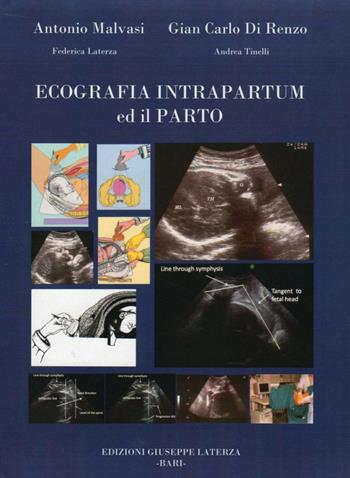 Ecografia intrapartum ed il parto  - Libro Edizioni Giuseppe Laterza 2012, Universitaria | Libraccio.it