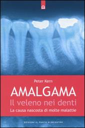 Amalgama. Il veleno nei denti. La causa nascosta di molte malattie