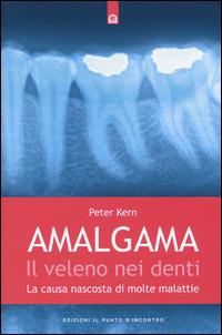 Amalgama. Il veleno nei denti. La causa nascosta di molte malattie - Peter Kern - Libro Edizioni Il Punto d'Incontro 2015, Salute e benessere | Libraccio.it