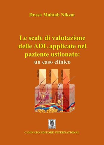 Le scale di valutazione delle ADL applicate nel paziente ustionato: un caso clinico. Ediz. illustrata - Mahtab Nikzat - Libro Cavinato 2021 | Libraccio.it
