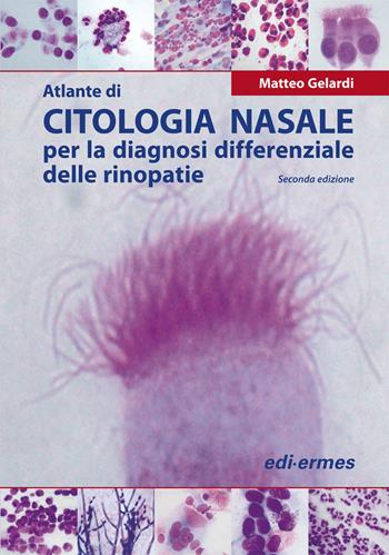 Atlante di citologia nasale per la diagnosi differenziale delle rinopatie - Matteo Gelardi - Libro Edi. Ermes 2012 | Libraccio.it