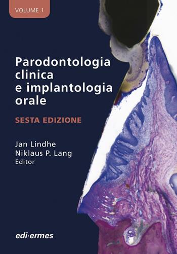 Parodontologia clinica e implantologia orale  - Libro Edi. Ermes 2016 | Libraccio.it